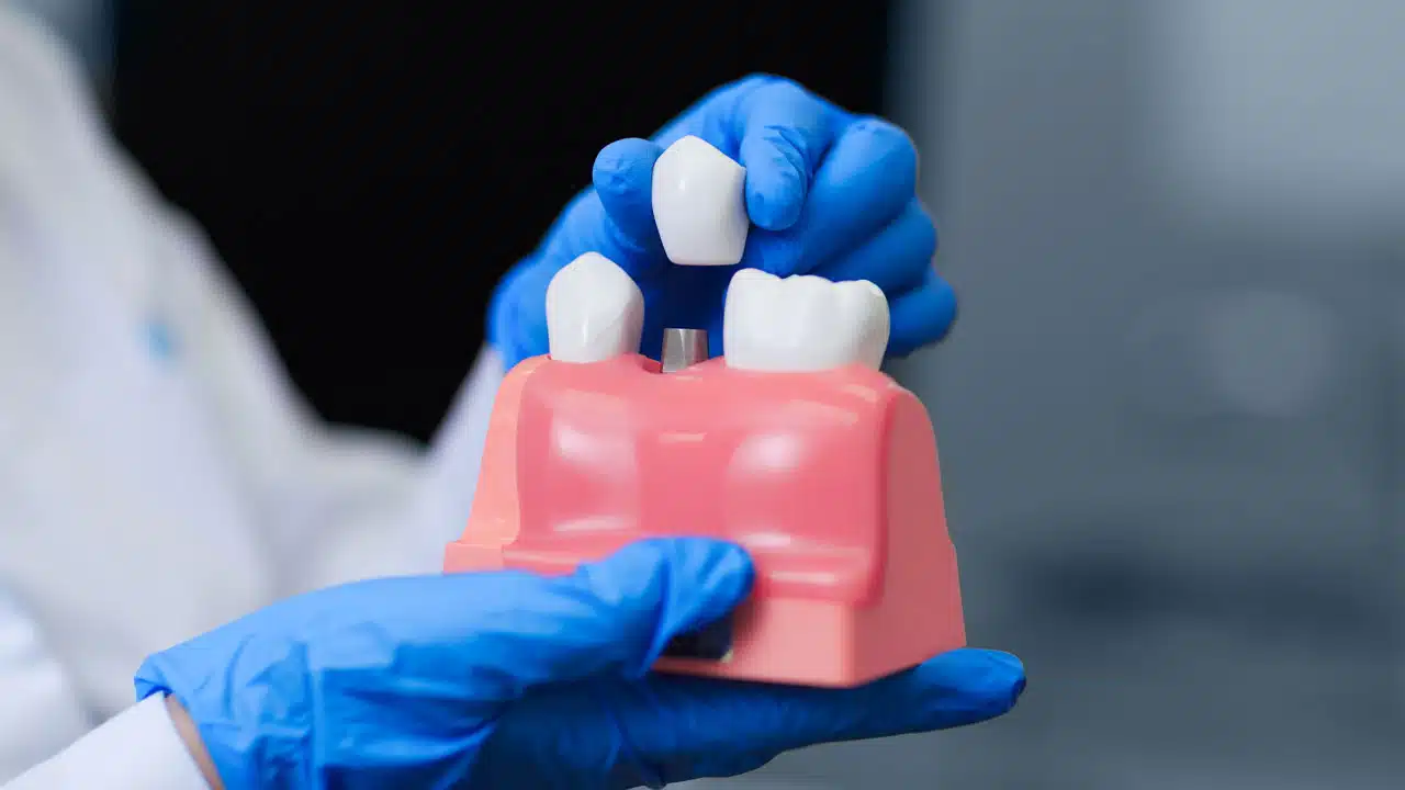 Dentist holding a model of teeth with dental restoration