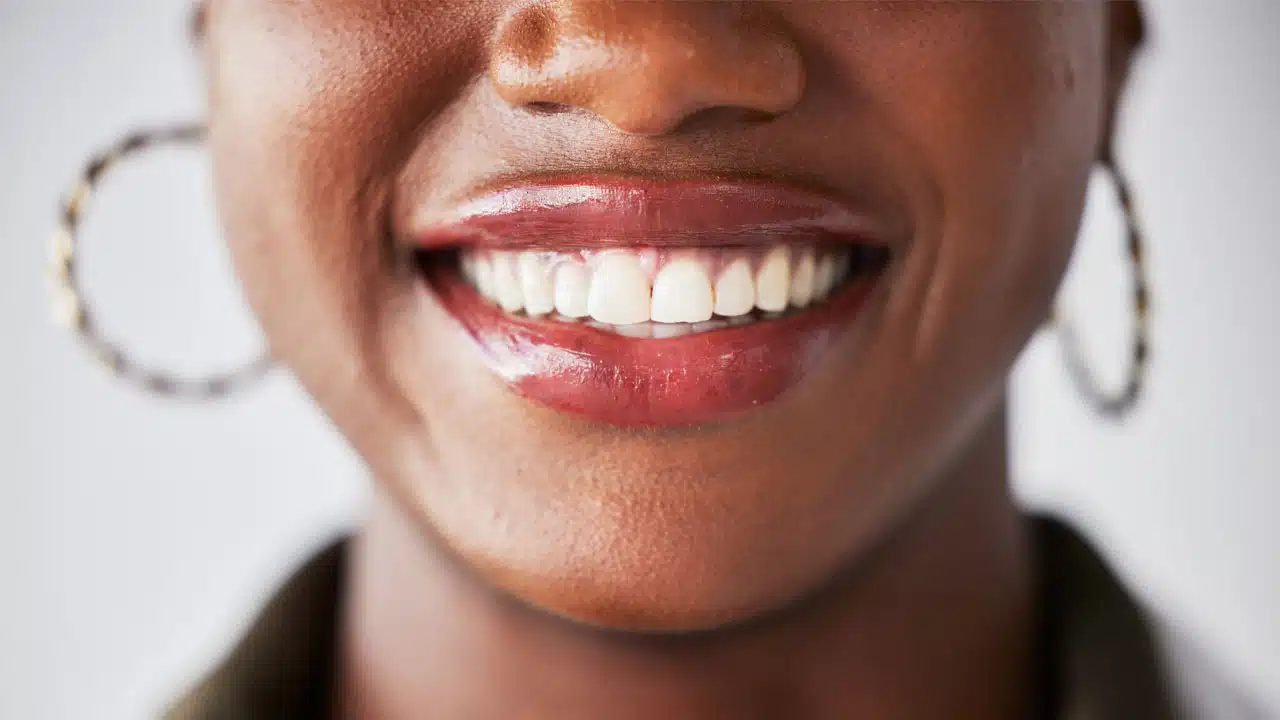 Woman smiling with beautiful teeth