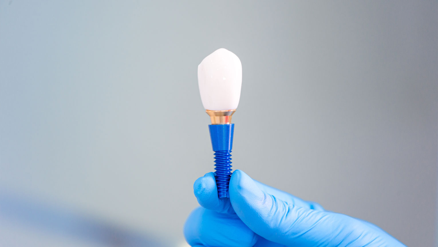 All on 4 Dental Implants A Revolutionary Tooth Replacement