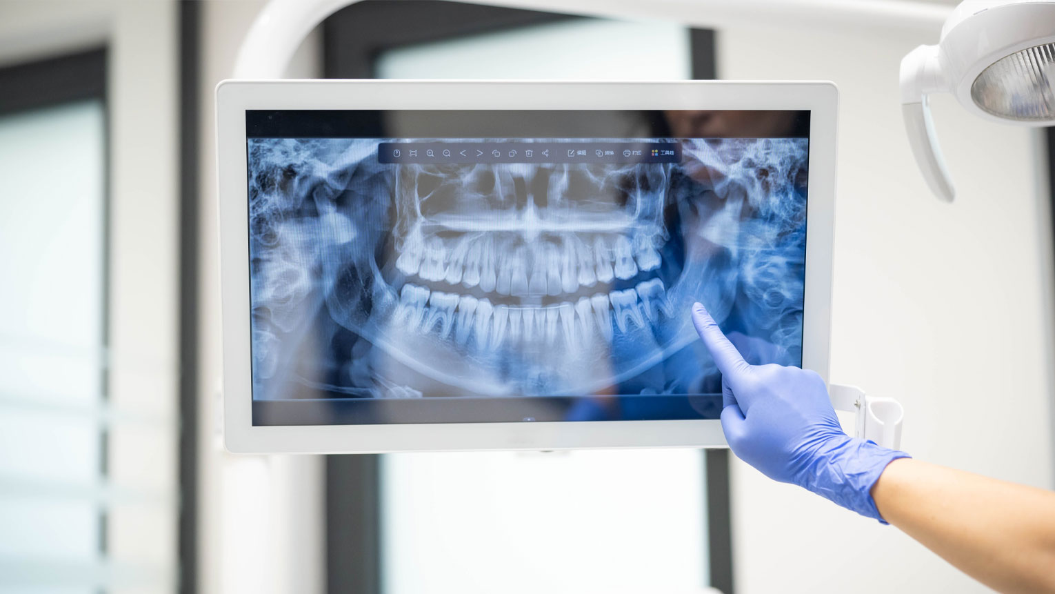 Are Dental X-Rays Safe The Truth About Dental Radiography