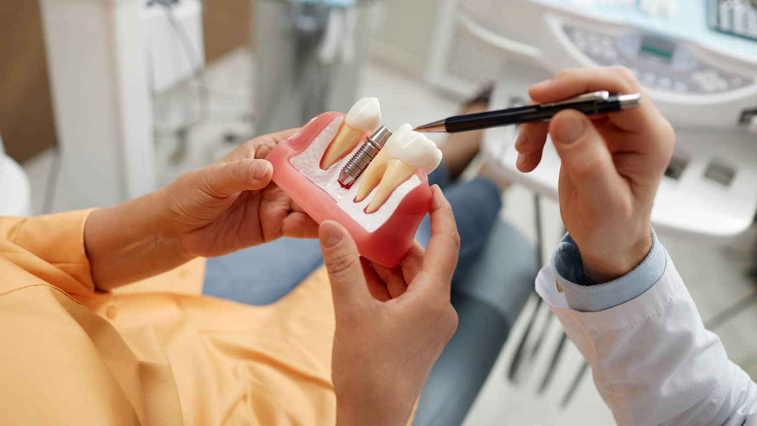 Dental Implant Steps Explained