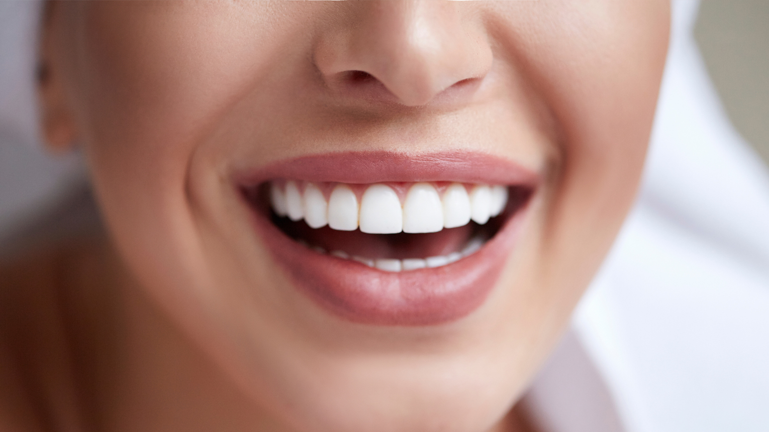 Everything You Need to Know About Veneers