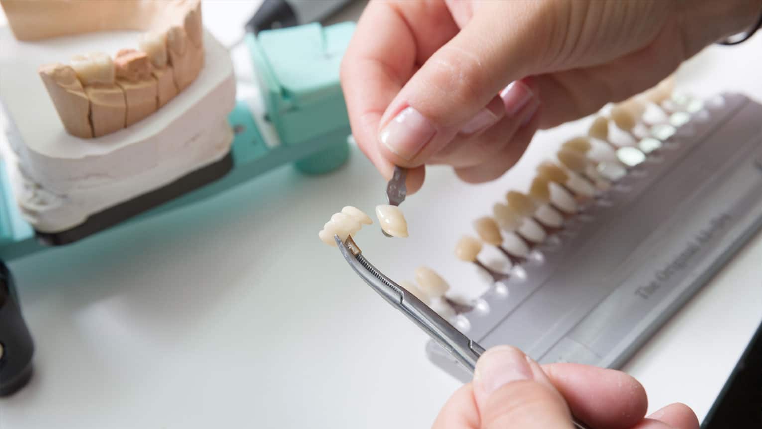 The Pros and Cons of Dental Veneers